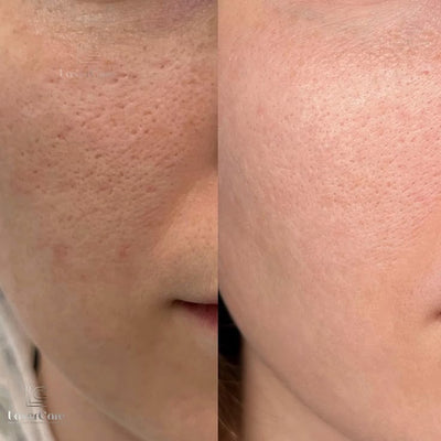 Week 1 - 2