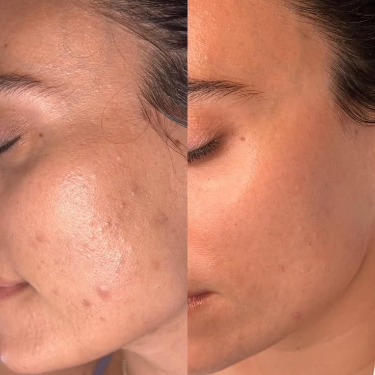 Before and after